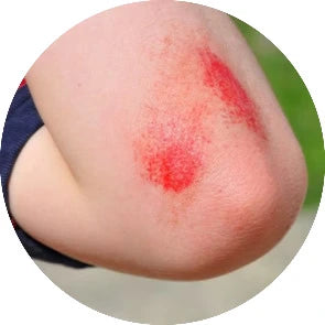 Herbal Antiseptic Range