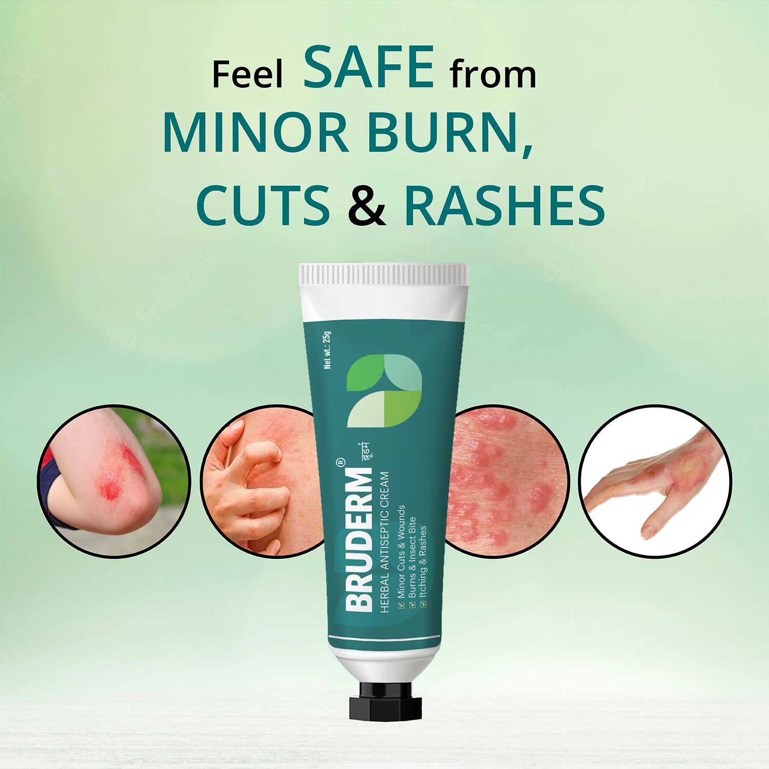 cream for skin rashes and itching